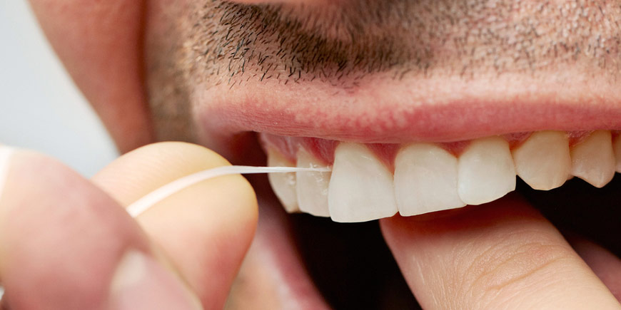 Flossing and Other Interdental Cleaning Methods - DENTAL VIP Posts